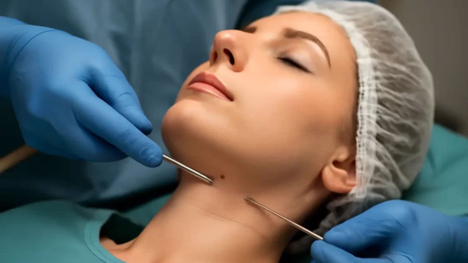 Double chin removal at FK Clinic – achieve a defined jawline and sleeker face