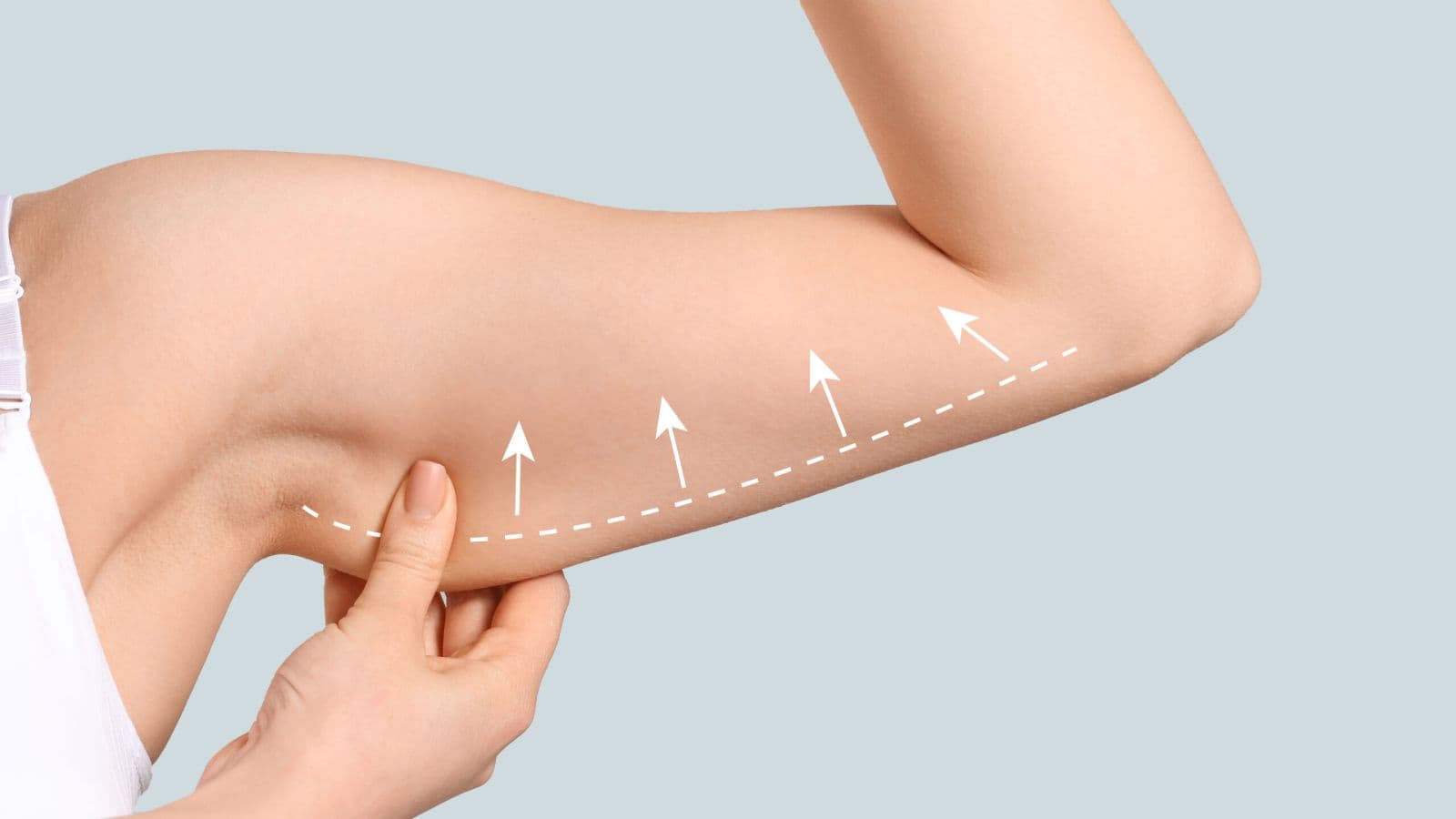 Arm lift at FK Clinic — slimmer, balanced arms