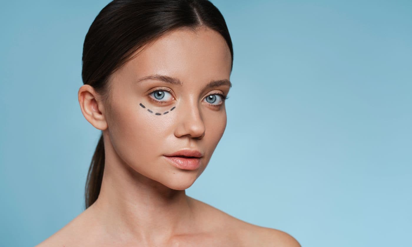 Steps of eyelid blepharoplasty