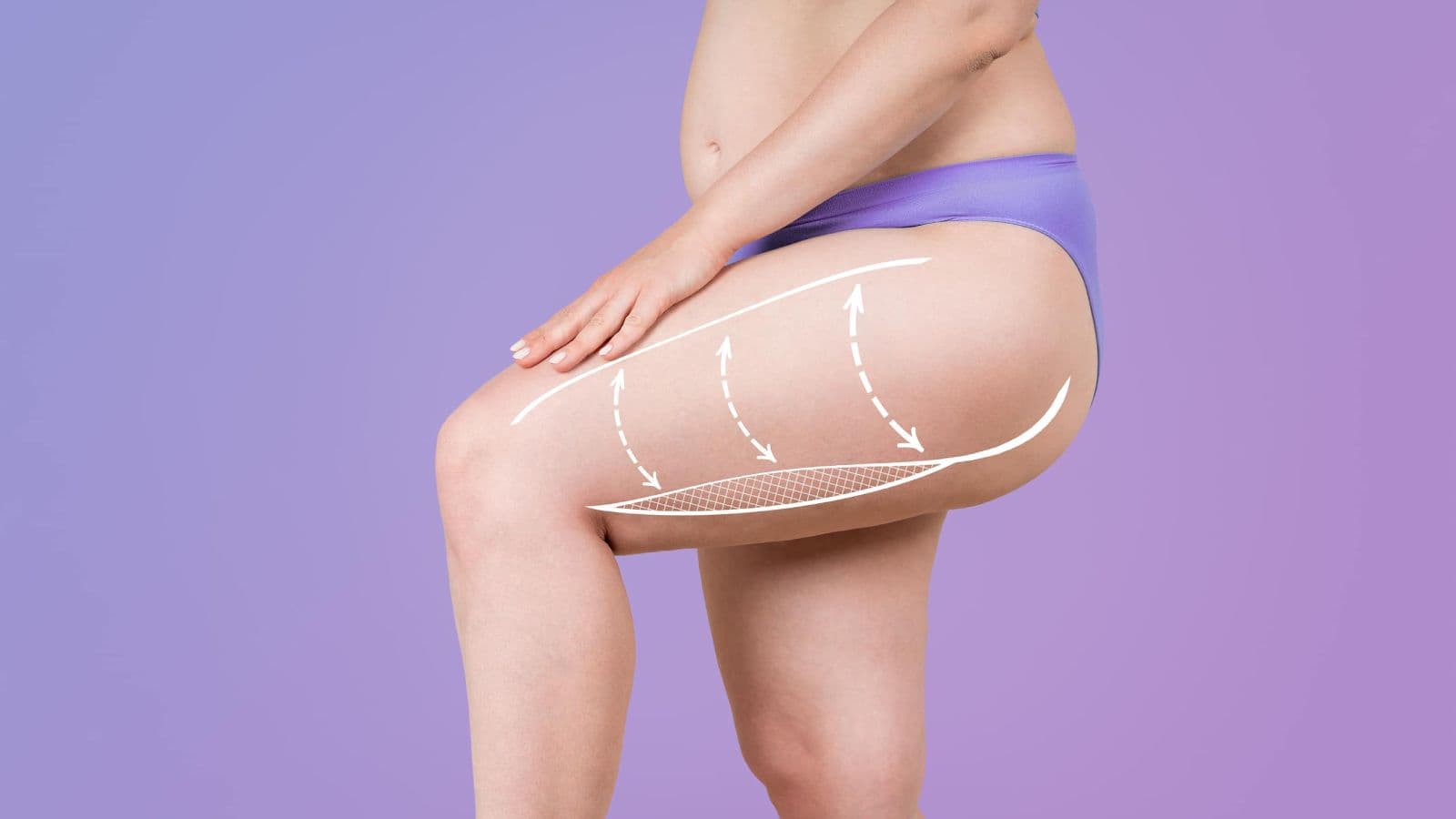 Thigh Lift | FK Clinic